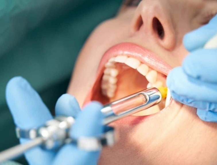 Operatoria dental